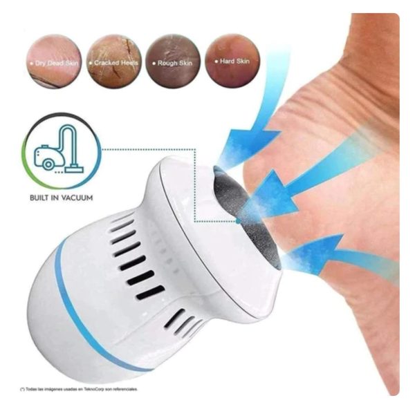 Removedor de Callos (Recargable e inalámbrico)