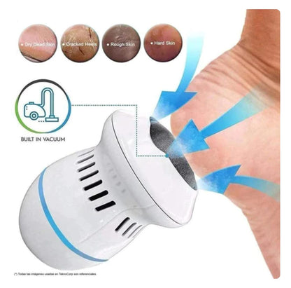 👣 REMOVEDOR DE CALLOS ELÉCTRICO – PIES SUAVES SIN IR AL SALÓN
