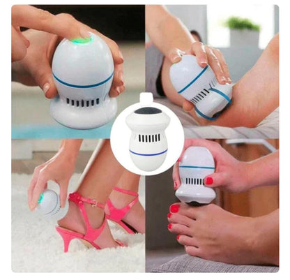 👣 REMOVEDOR DE CALLOS ELÉCTRICO – PIES SUAVES SIN IR AL SALÓN