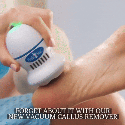Removedor de Callos  (Recargable e inalámbrico)
